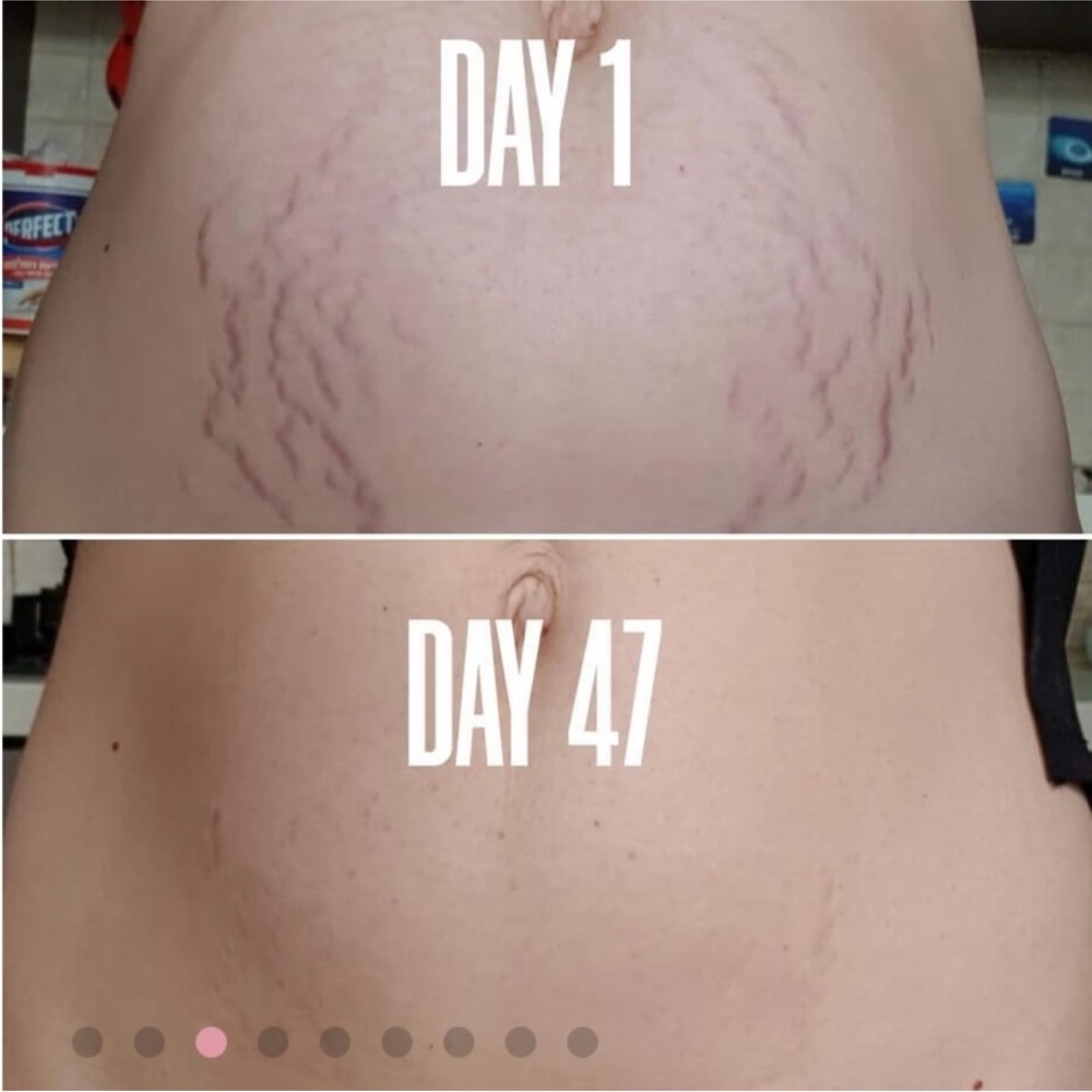Maelys B-FLAT Belly Firming Cream. 2 available. - Picture 6 of 9